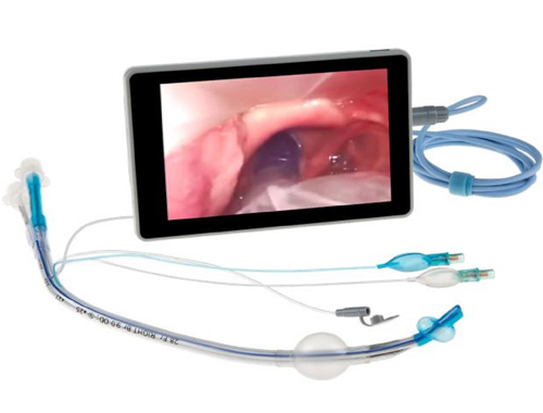VİDEO ENDOBRONŞİAL TÜPLER